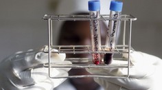 Studie velmi znepokojila vědce. V lidské krvi našli mikroplasty