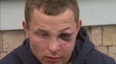 Vondrášek má zlomeninu lícní kosti a naštípnuté další kůstky. ROZHOVOR