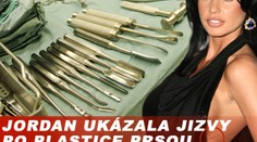 Jordan nechtěně ukázala jizvy po plastice prsou