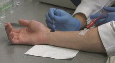 Nová naděje! Čip dokáže uzdravit buňky, stačí ho přiložit ke kůži