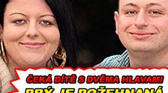 Čeká dítě s dvěma hlavami. Prý je požehnaná