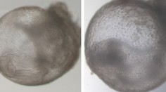 Přelom ve vědě. Výzkumníci vypěstovali první umělé embryo bez spermie i vajíčka