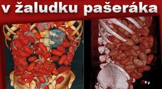 Pašerák měl v žaludku 72 balíčků kokainu