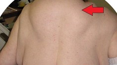 Ženě narostl hrb! Kvůli činnosti, kterou děláme všichni