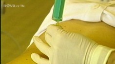 Převratná novinka! Místo plodové vody stačí otestovat krev a DNA