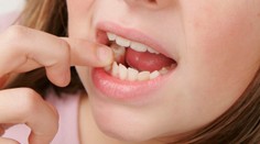 Další zoufalá žena si trhala zub doma! Použila jsem nůžky na nehty, popsala