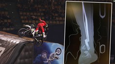 Děsivé video! Motorkář Podmol si při závodě zlomil obě nohy