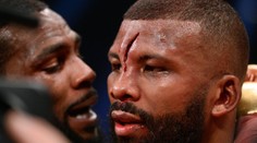 Jatka v ringu! Boxer soupeři otevřel hlavu a jizva teď děsí svět
