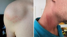 "Strážníci nám brutálně napadli zaměstnance," tvrdí neziskovka