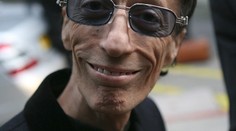 Robin Gibb z Bee Gees zemřel. Zabila ho rakovina