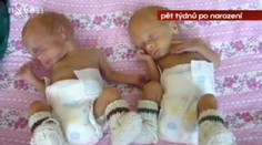 Počet nedonošených dětí roste, péče ale pokulhává