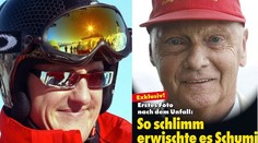 NECHUTNÉ! Tropí si ze Schumiho šprýmy? Prý teď vypadá stejně špatně jako Niki Lauda