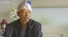 23 let žil s KULKOU v hlavě a nevědl o tom! Nyní mu ji doktoři vyndali