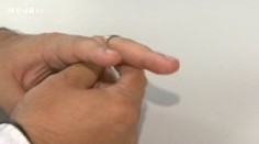 Prstýnky z chirurgické oceli: nebezpečí pro vaše prsty