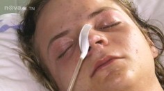 Trojice útočníků v Břeclavi brutálně zmlátila mladíka (15). Přišel o ledvinu!