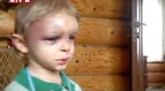 Krkavčí matka skoro ubila bezbranného chlapečka k smrti