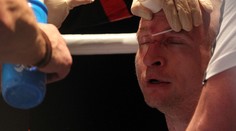 Konečný má zánět spojivek a řeší, co se v Kyjevě vlastně stalo