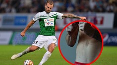 Vít Beneš může hrát i bez ledviny! V Maďarsku dostal povolení