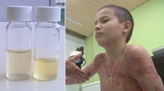 Čeští vědci vymysleli revoluční gel, lečí popáleniny i zlomeniny
