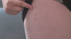 Dětskou ozdravovnu zaplavily štěnice. Jejich vyhlazení stálo statisíce