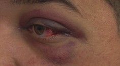 Jak to jezdíš? řvali na řidiče. Pak ho seřezali baseballkou