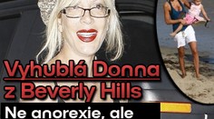 Vyhublá Donna z Beverly Hills: Ne anorexie, ale prasečí chřipka