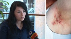 Elena se styděla svléknout i do plavek. Trápila ji odporná choroba!