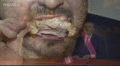 HUBNUTÍ PO VÁNOCÍCH: Přečtěte si NEJLEPŠÍ DIETY
