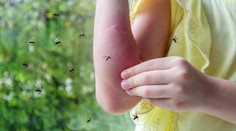 MAPY: Komáři pořádně potrápí Česko. V příštích dnech jejich aktivita poroste