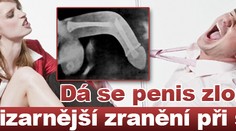 Dá se penis zlomit? Nejbizarnější zranění při sexu
