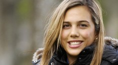Této krásce plameny zničily tvář. Po dvou letech odkryla svůj zohavený obličej! GALERIE