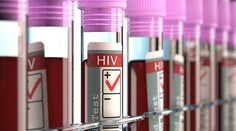 Vědci hlásí průlom v léčbě HIV. Máme "vypínač" viru, tvrdí!