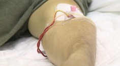 V Česku se šíří žloutenka typu A. Nejvíce postižený je Moravskoslezský kraj