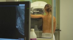 Rakovinu prsu, kterou našli Slováčkové, je důležité léčit včas. Tak se dá porazit