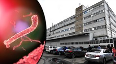 V Rusku explodovala laboratoř s viry HIV, eboly či pravých neštovic!