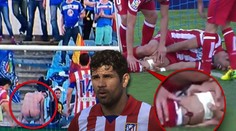 VIDEO: Holý zadek, zahozená penalta a tržná rána na holeni! Costa byl u všeho