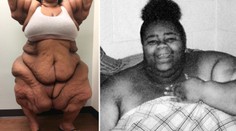 Musíte vidět: Nejtěžší žena světa shodila 200 kilogramů! GALERIE