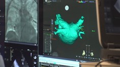 Pokrok v léčbě srdeční arytmie. Nová metoda českých lékařů je rychlejší a šetrnější