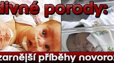 Podivné porody: nejbizarnější příběhy novorozeňat