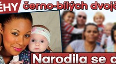 PŘÍBĚHY černo-bílých dvojčátek: narodila se další!