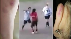 Za faul se pomstila tvrdým loktem! Fotbalistka zůstala ležet VIDEO