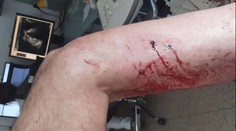 Agresor na muže bezdůvodně poštval psa. Navíc mu přidal kopance