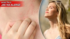 Alergie dokáže potrápit i v létě. TIPY jak ji zmírnit