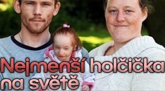 Nejmenší holčička na světě: jsou jí tři a váží 3,5 kila