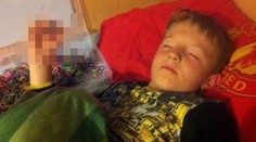 Gumičková závislost: Školák (8) málem přišel o prsty! Foto uvnitř
