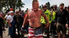 Modřiny, krev a mléko: V Berkeley se kvůli Trumpovi popralo 200 lidí