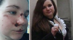 Záhada! Terezu (28) našli v kaluži krve. Nepamatuje si, co se stalo