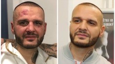 Marpo Rytmusovi upravil fasádu! Fotky rappera před a po zápase