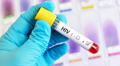 V Česku rostou případy HIV. Lidé si myslí, že se jich infekce netýká