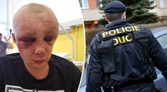 Policie zná totožnost útočníků na mladého vojáka! Přihlásili se sami
